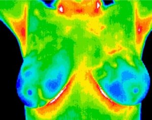 Thermography Testing